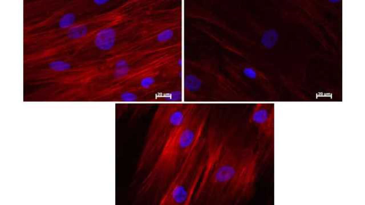 Embryonic gene Nanog reverses aging in adult stem cells