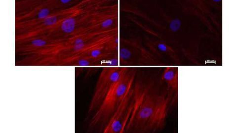 Embryonic gene Nanog reverses aging in adult stem cells