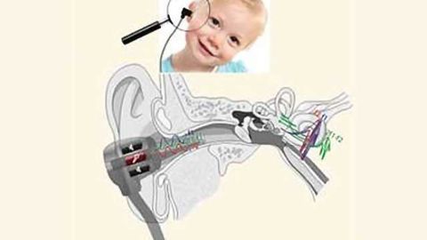 Ear test may identify autism risk