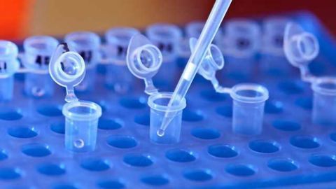 New gene variants present in 3 percent of all ALS patients