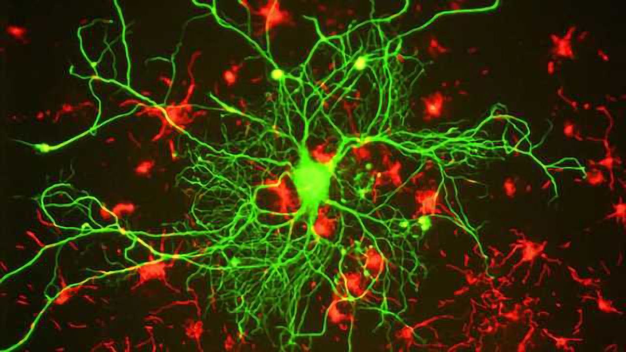 New evidence: How amino acid cysteine combats Huntington's disease