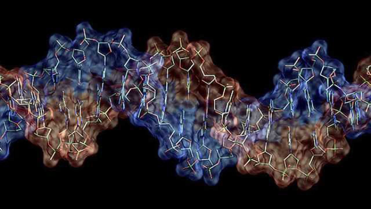 Why brain neurons in Parkinson's disease stop benefiting from levodopa