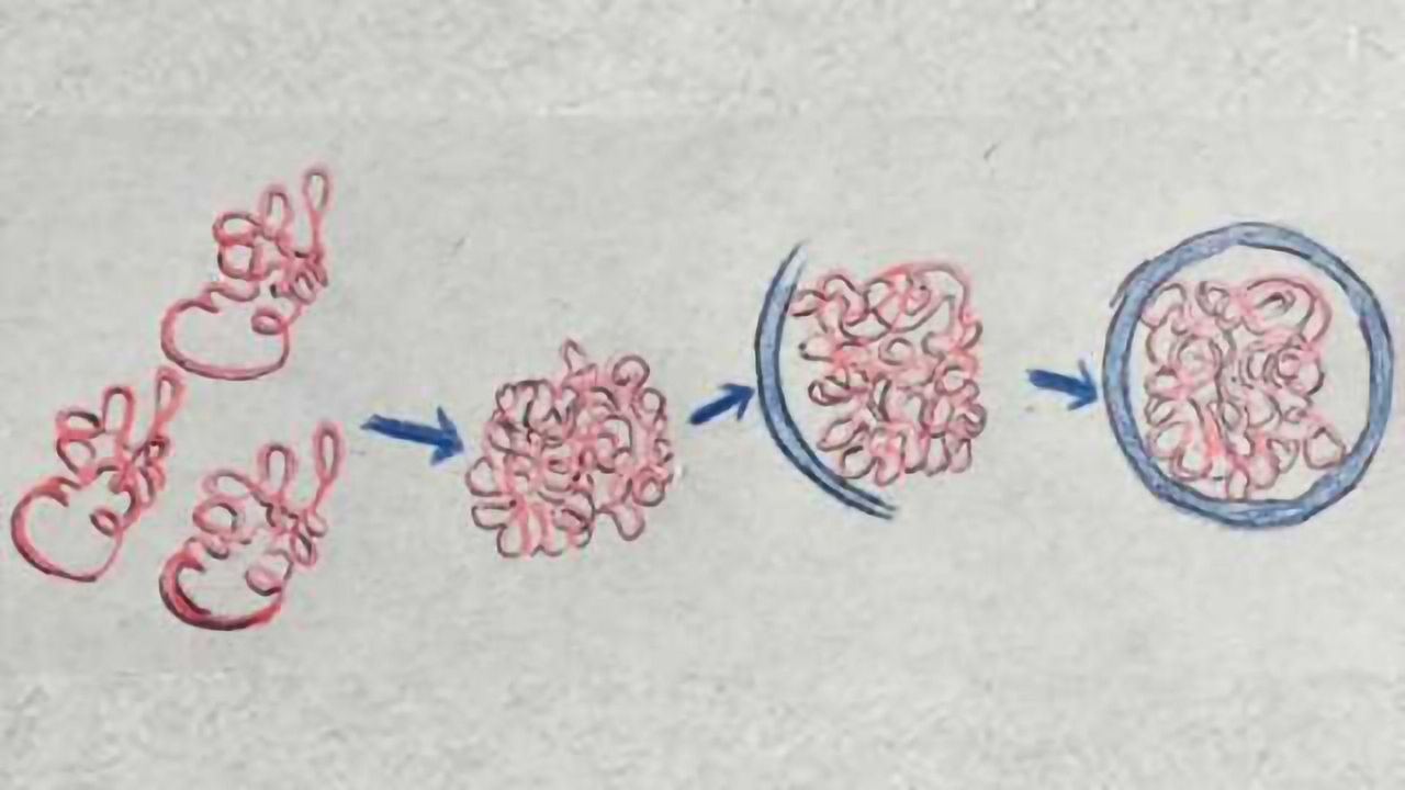 Big trash pickup: How cells handle 'big item' pickup