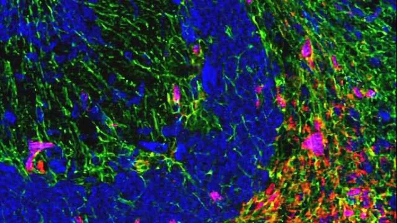 Scientists keep a molecule from moving inside nerve cells to prevent cell death