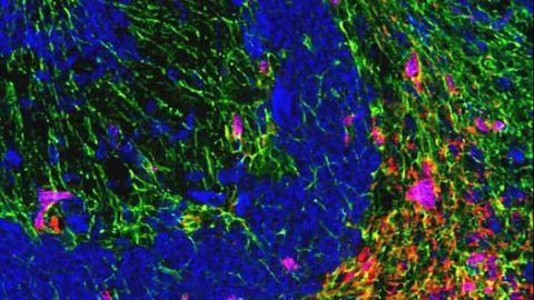 Scientists keep a molecule from moving inside nerve cells to prevent cell death