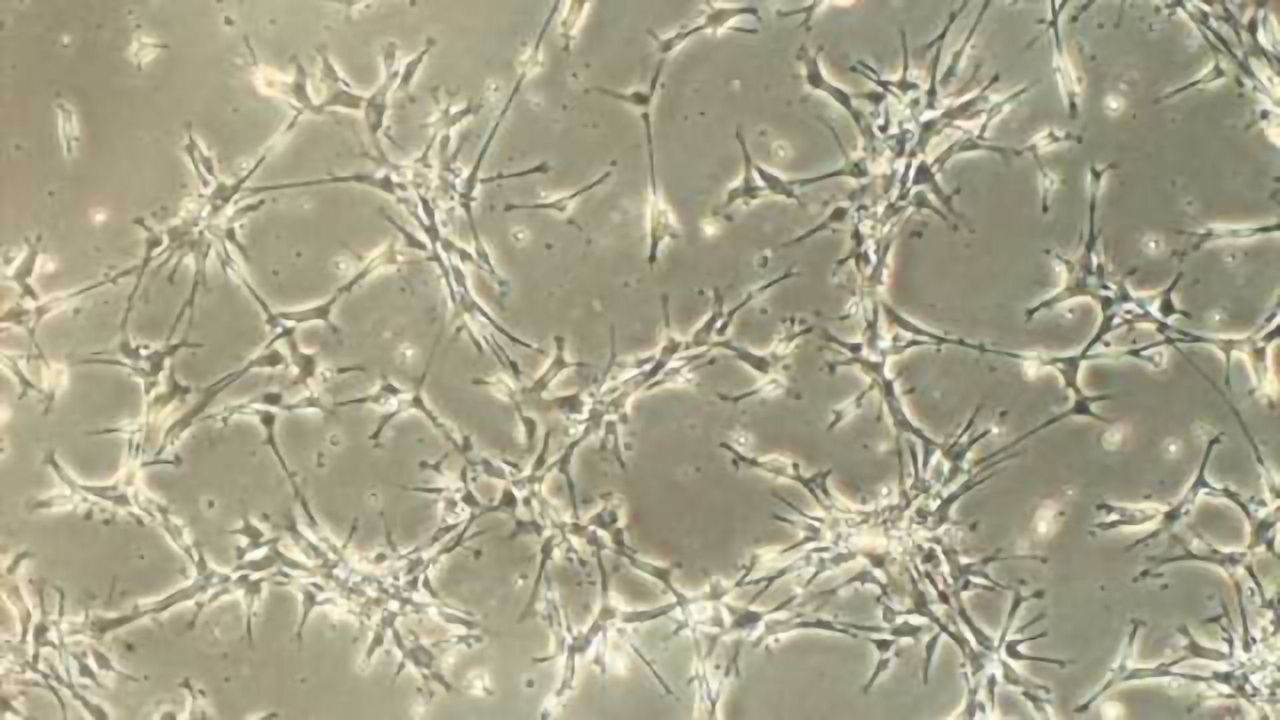 New ways to mass produce human neurons for studying neuropsychiatric disorders