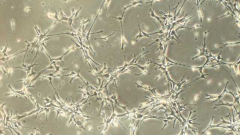 New ways to mass produce human neurons for studying neuropsychiatric disorders