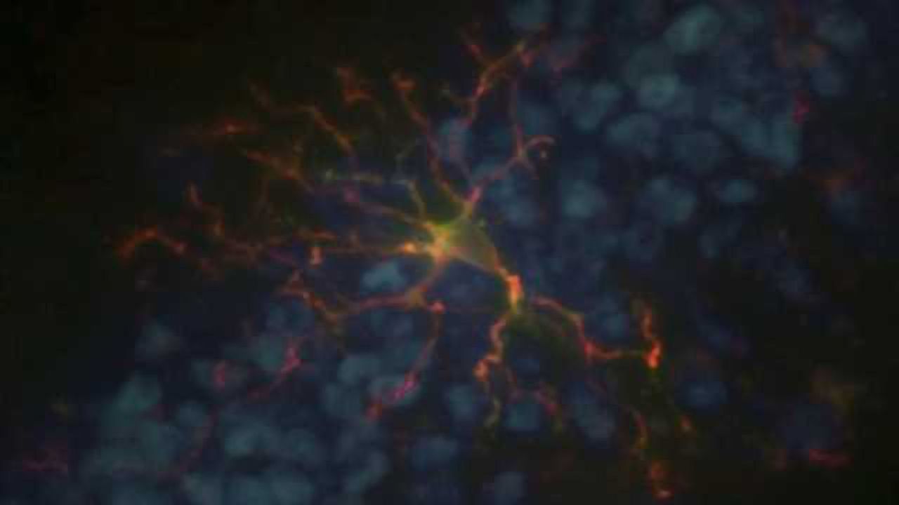 Seasonal allergies could change your brain