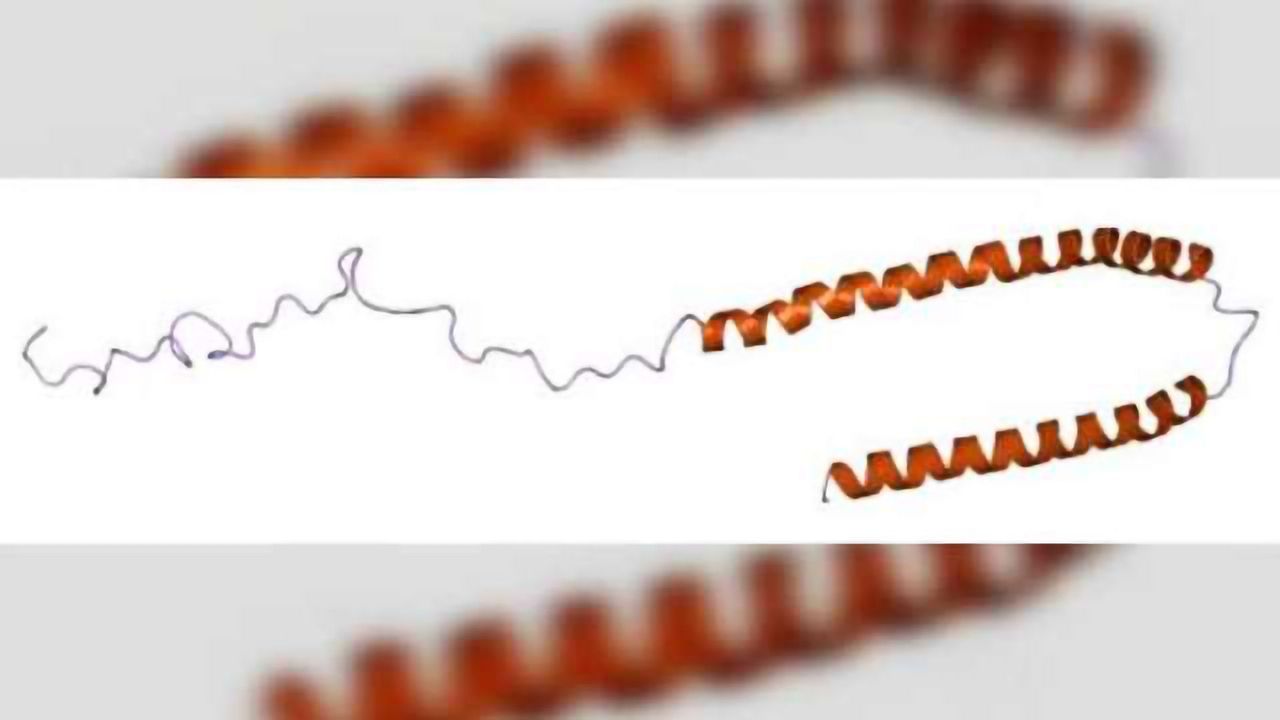 New model recreates early spread of Parkinson’s disease in the brain