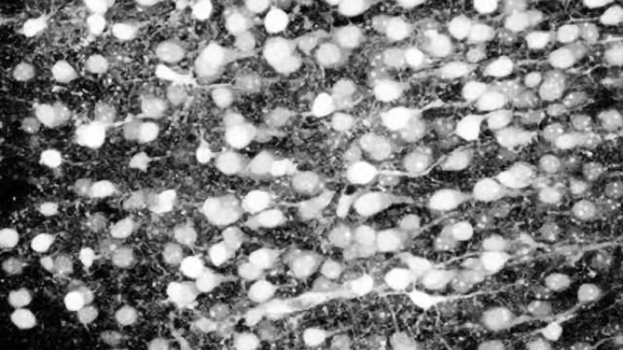 Researchers 'reprogram' network of brain cells in mice with thin beam of light