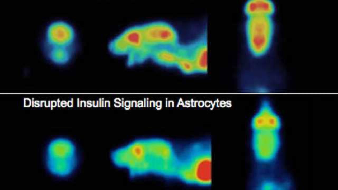 Discovery of a brain sugar switch