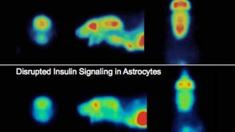 Discovery of a brain sugar switch
