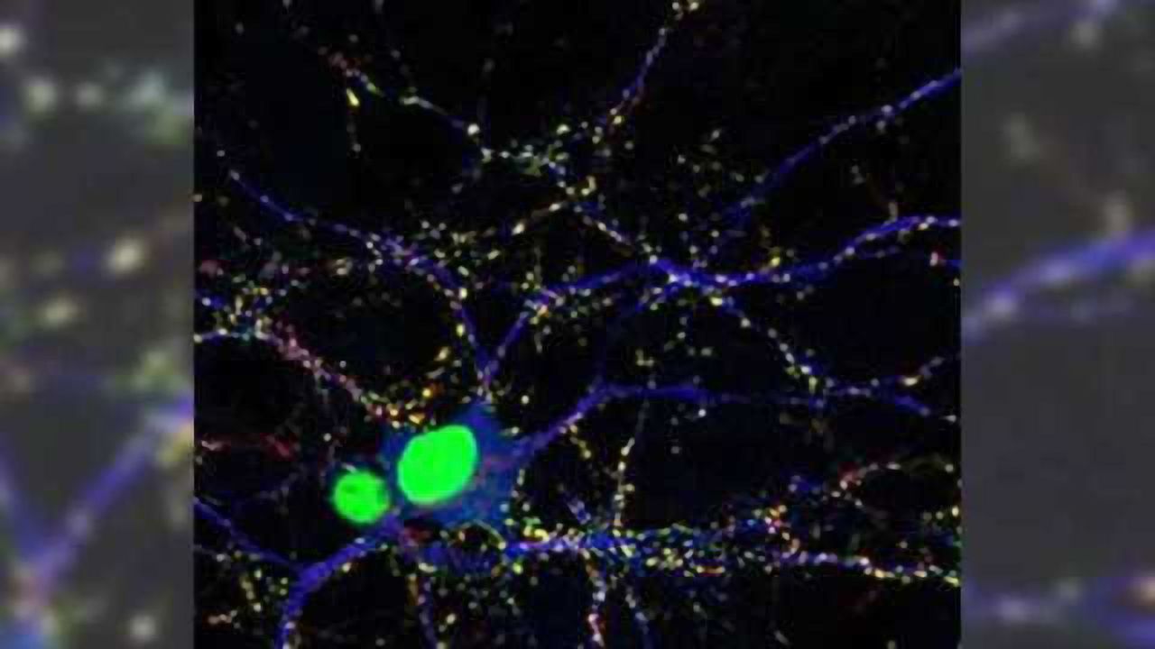 A neuron's hardy bunch