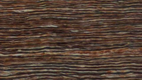 Cell therapy promotes axon remyelination in a mouse model