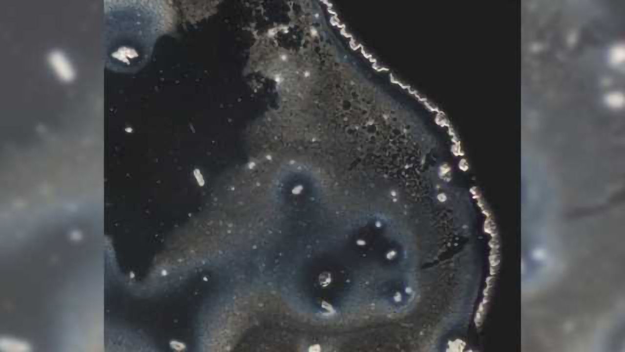 New study shows LSD's effects on language