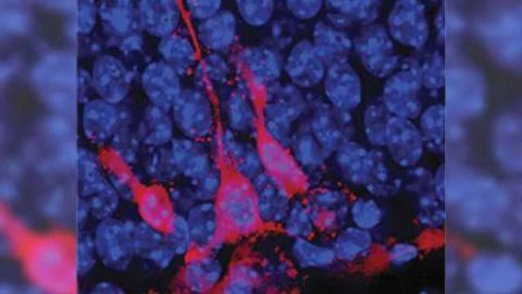 In unstable times, the brain reduces cell production to help cope
