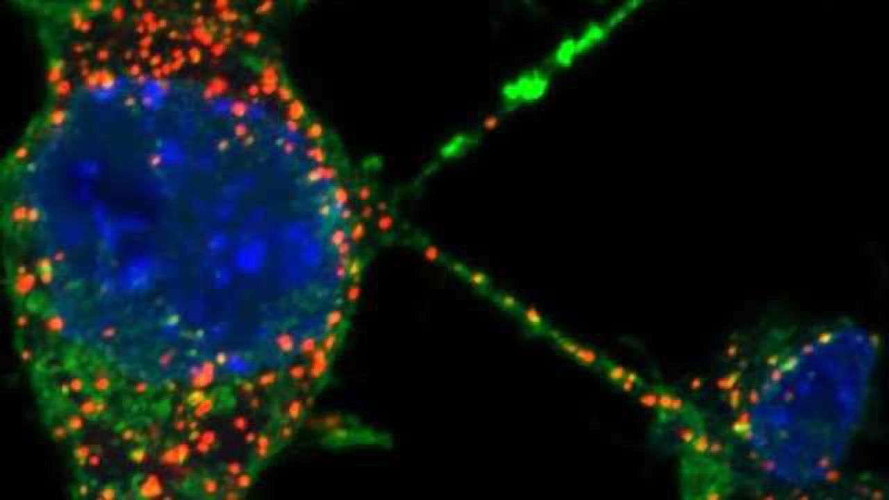 Tunneling nanotubes between neurons enable the spread of Parkinson's disease via lysosomes