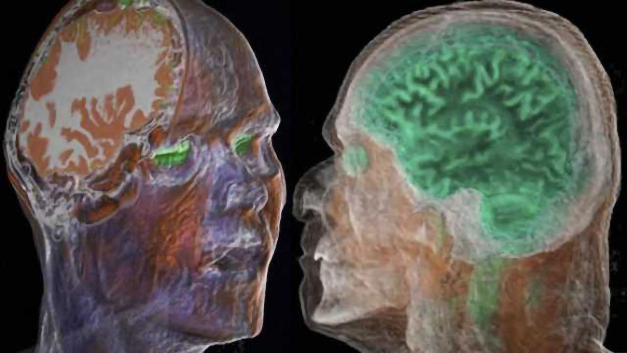 Post-mortem assessment guidelines for vascular cognitive impairment
