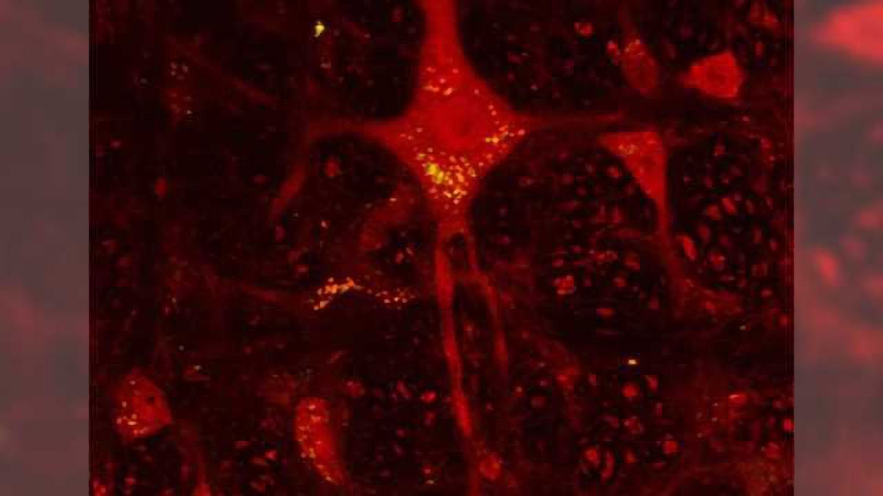 Activity of Huntington's disease gene curbed for 6 months in mice