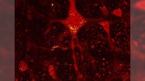Activity of Huntington's disease gene curbed for 6 months in mice