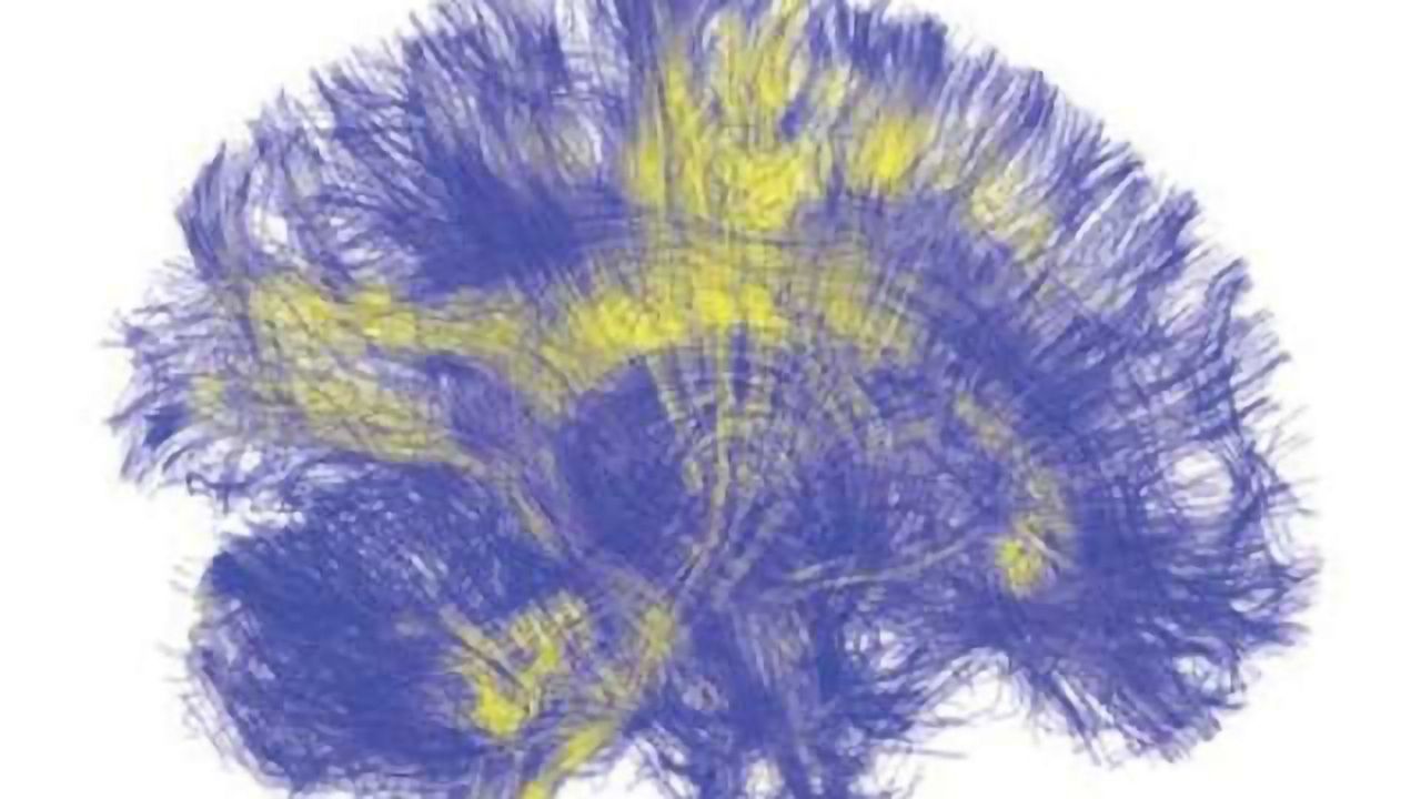 Study describes what happens when the brain is artificially stimulated