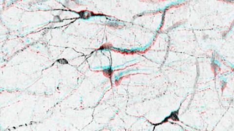 Scientists track down possible new treatment for epilepsy