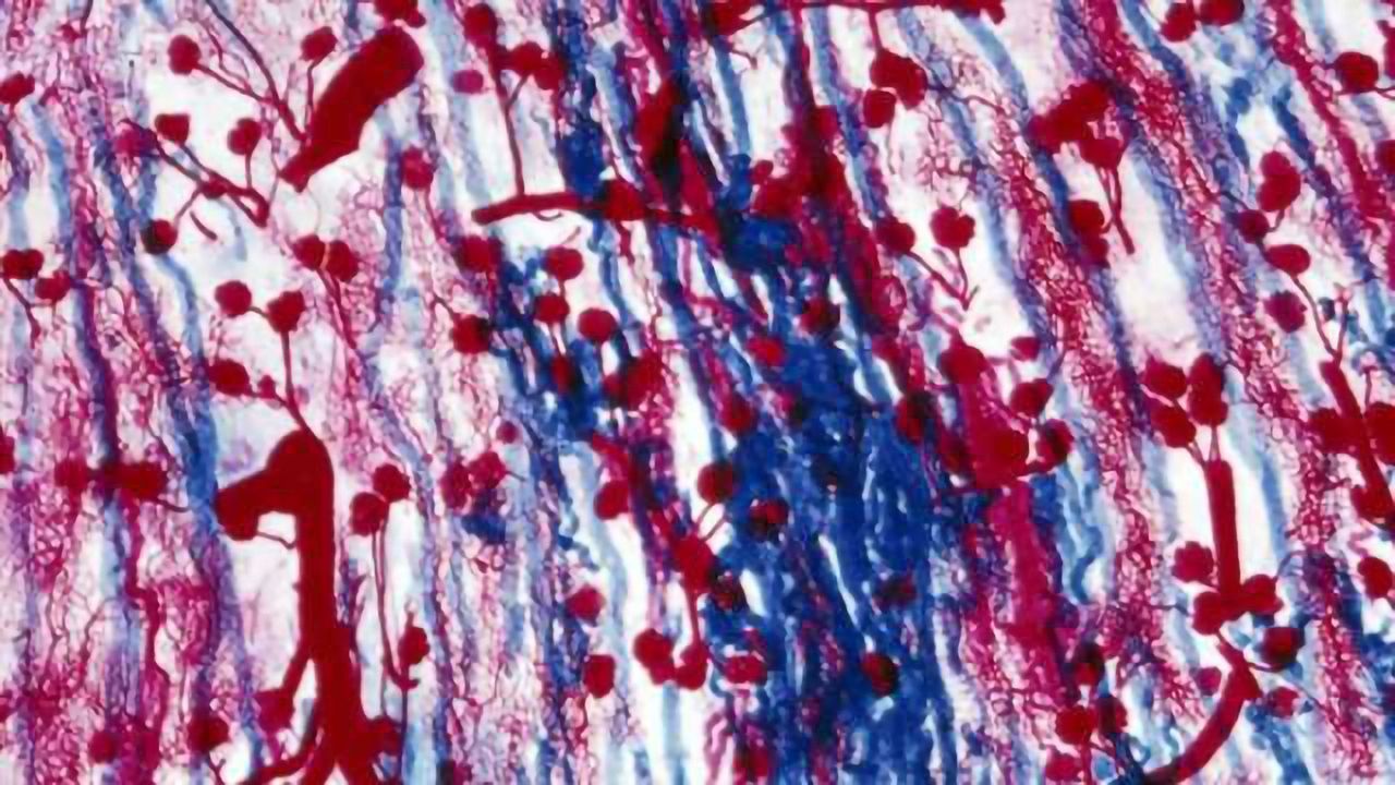 'Teashirt' gene links autism and kidney problems, new study finds
