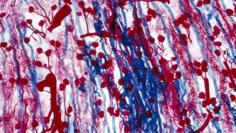 'Teashirt' gene links autism and kidney problems, new study finds