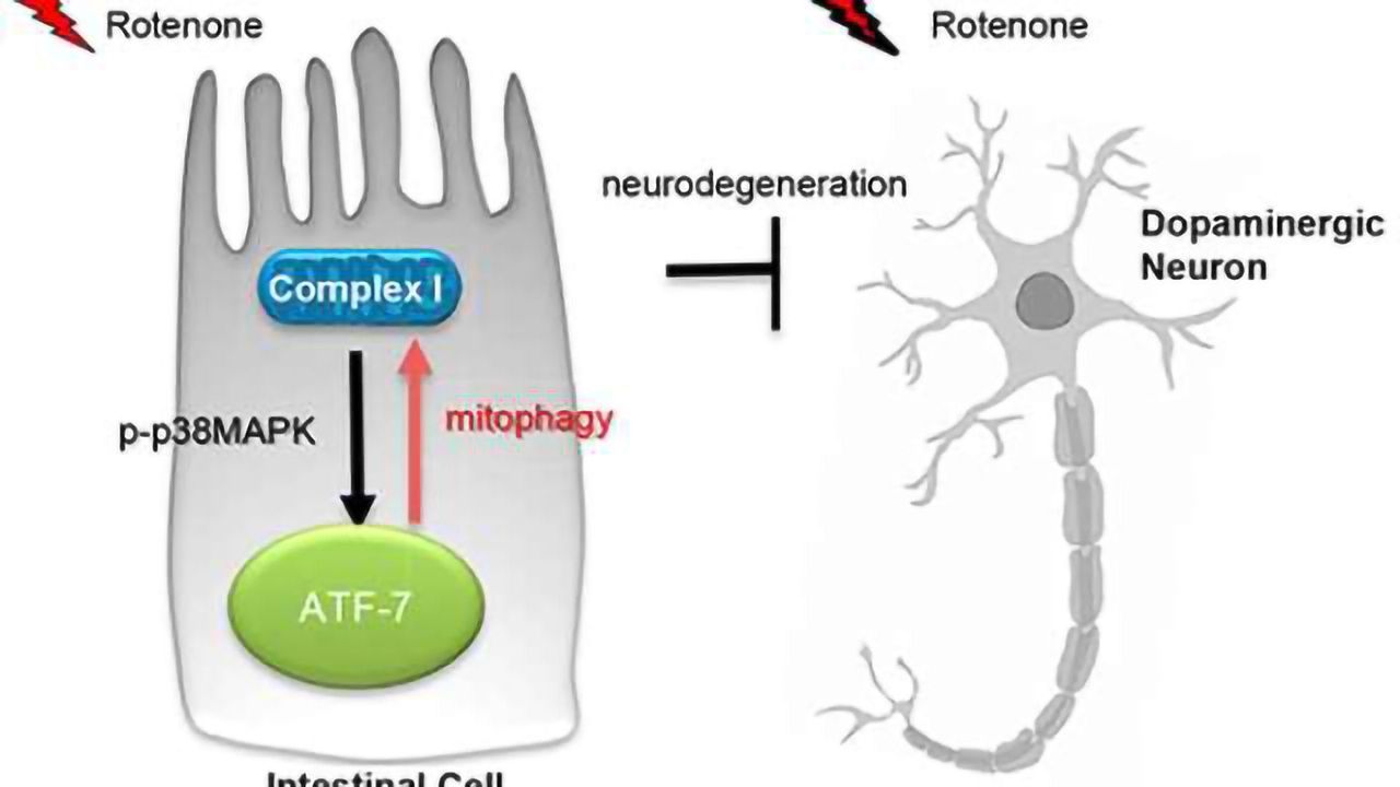 Parkinson's disease protection may begin in the gut