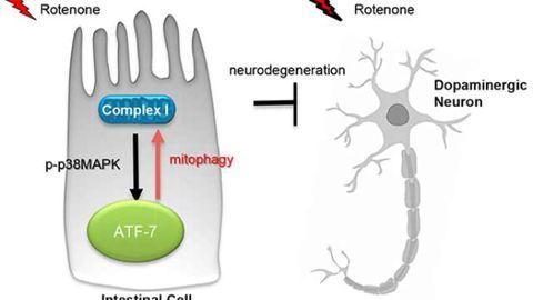 Parkinson's disease protection may begin in the gut