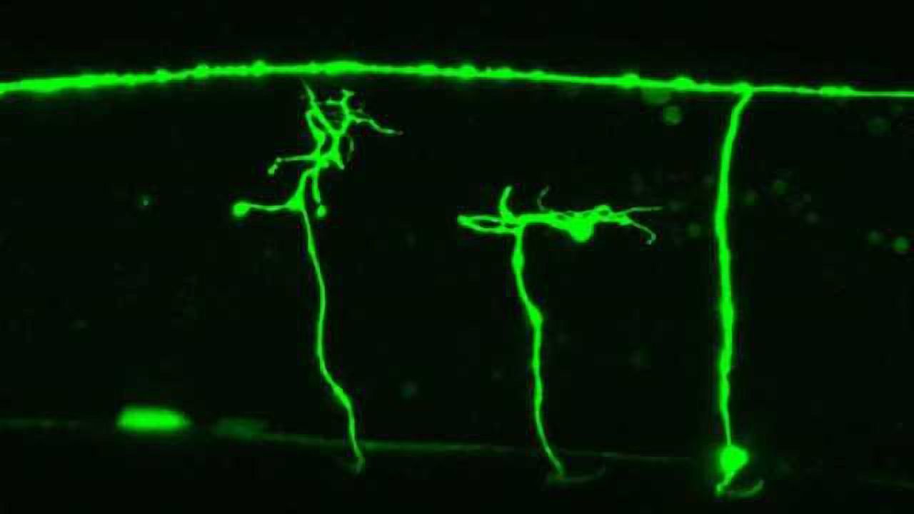 Unraveling roundworm nerve regeneration mechanism could aid nerve injury treatment