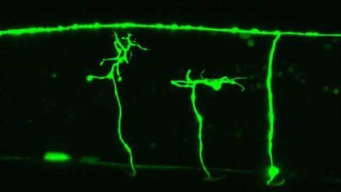 Unraveling roundworm nerve regeneration mechanism could aid nerve injury treatment
