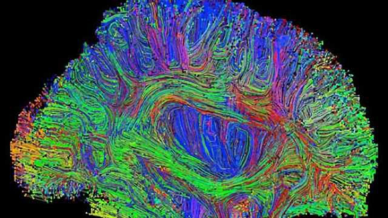 Does brain size really matter?