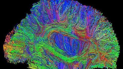 Does brain size really matter?