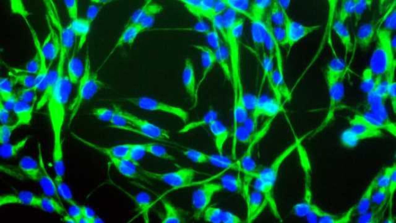 Transplantation with induced neural stem cells improves stroke recovery in mice