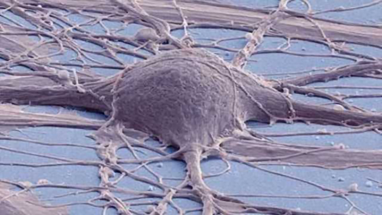 Dysfunction in neuronal transport mechanism linked to Alzheimer's disease