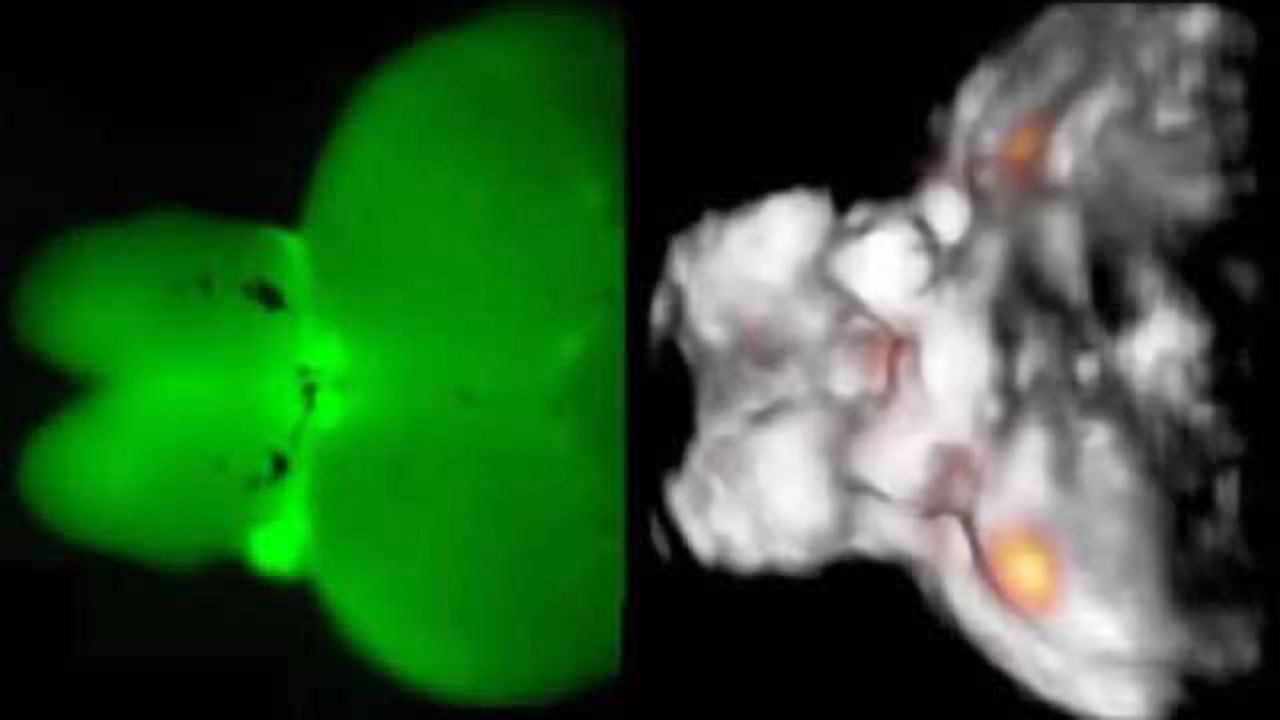 Watching the brain in action