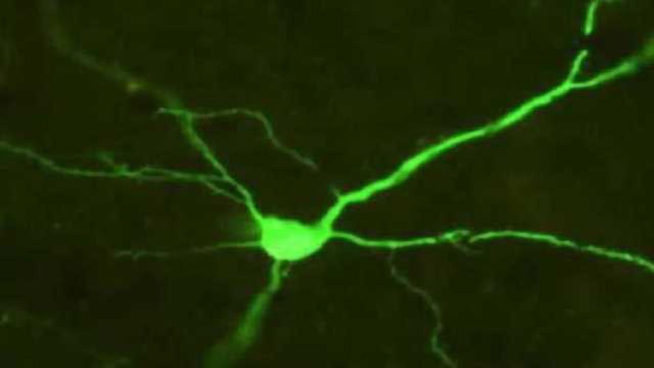 Study provides insight on why risk-taking behavior increases during adolescence