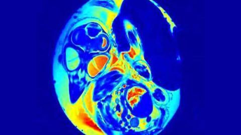 Neurodevelopmental model of Zika may provide rapid answers