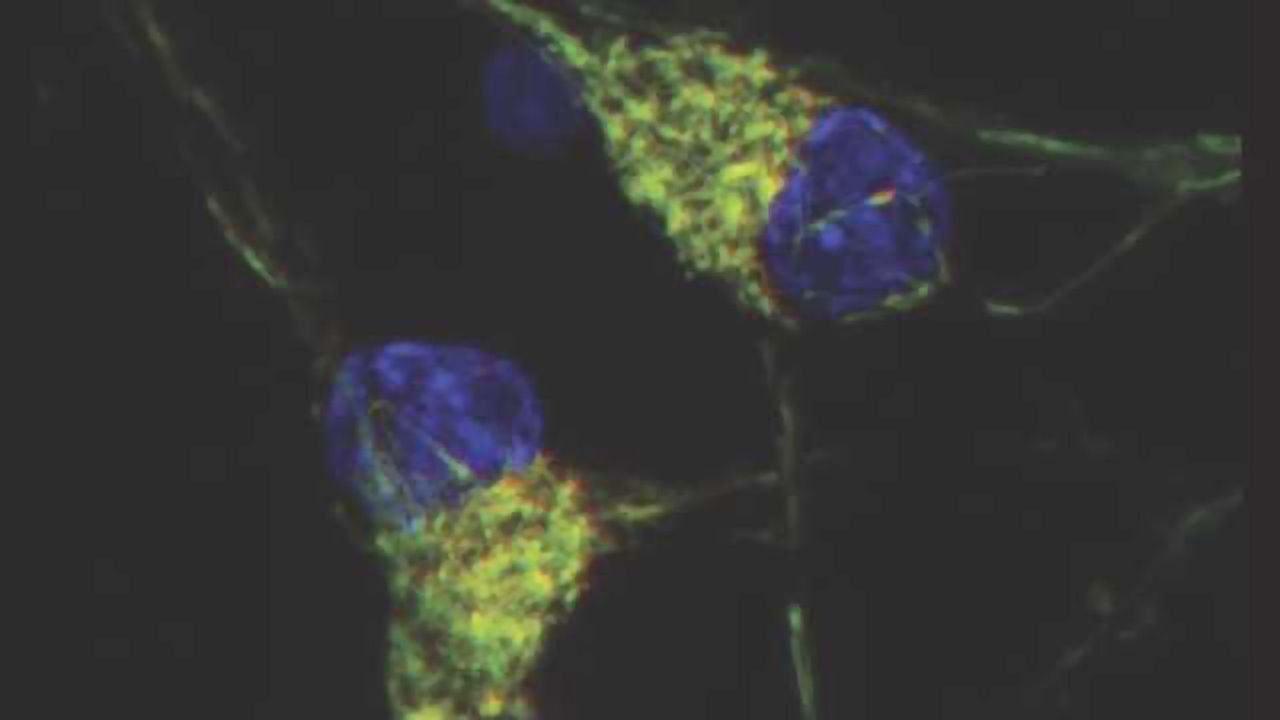 Impaired recycling of mitochondria in autism?
