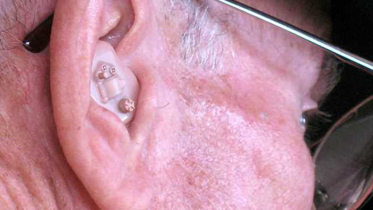 It's not your ears, it's your brain