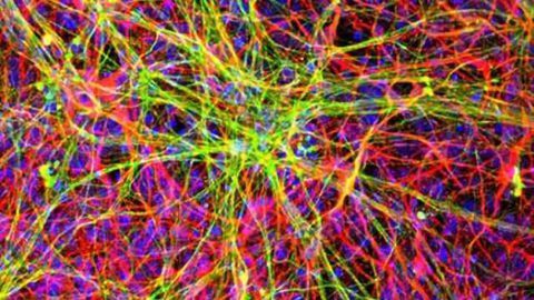 ALS study reveals role of RNA-binding proteins