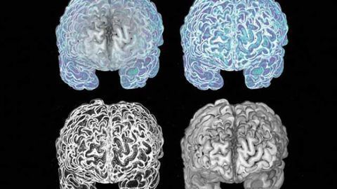 Study uncovers brain changes in offending pedophiles