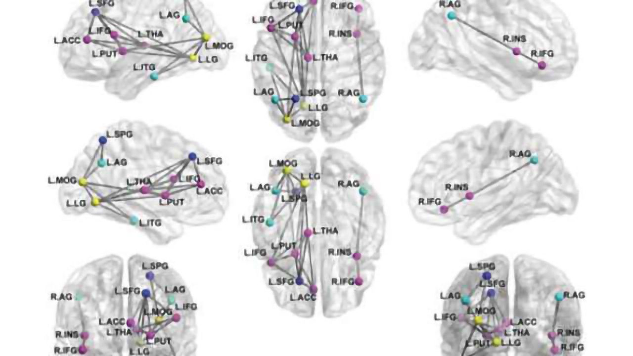 MRI shows brain disruption in children with PTSD