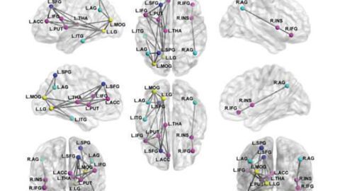 MRI shows brain disruption in children with PTSD