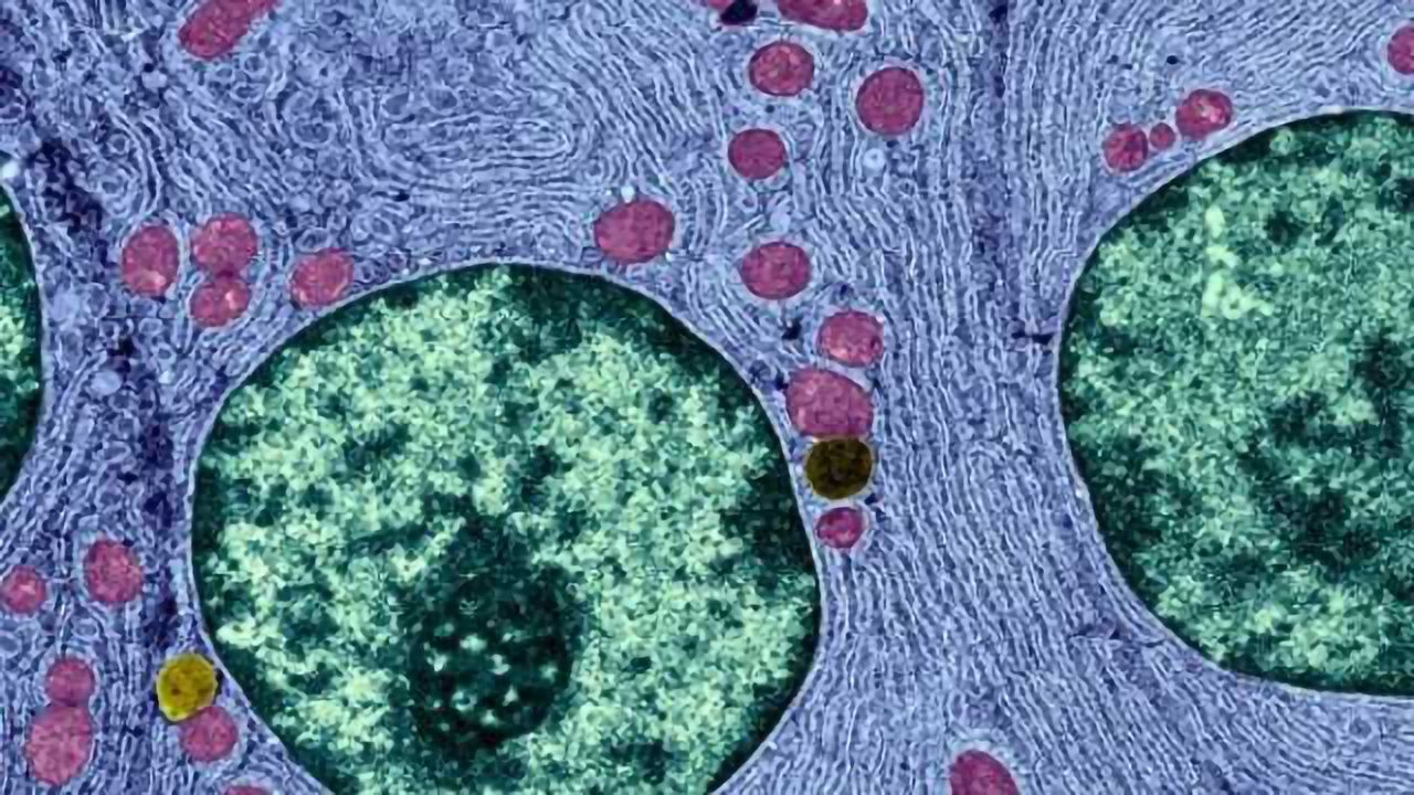 Study shows link between mitochondrial DNA and autism
