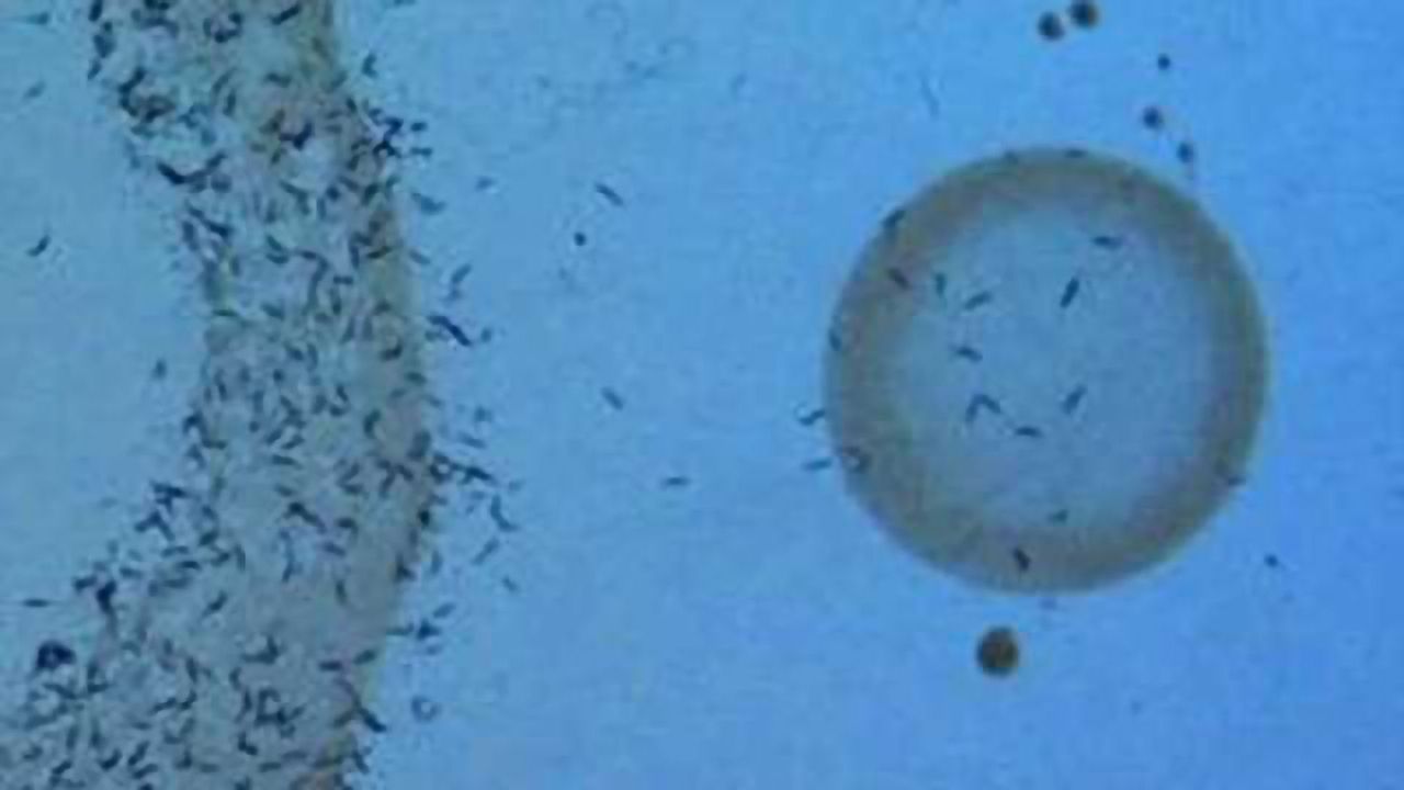 Scientists prove how genetics change behavior by studying worms' foraging strategies