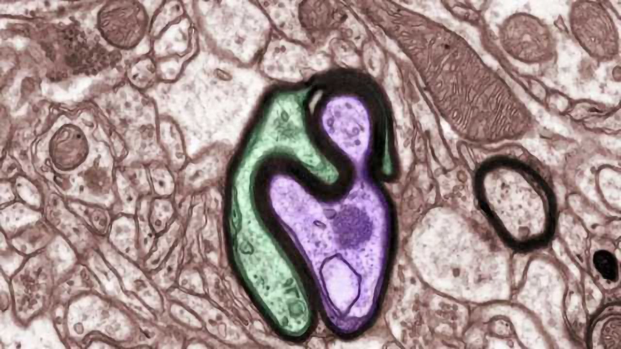 Potential target identified for preventing long-term effects of traumatic brain injury
