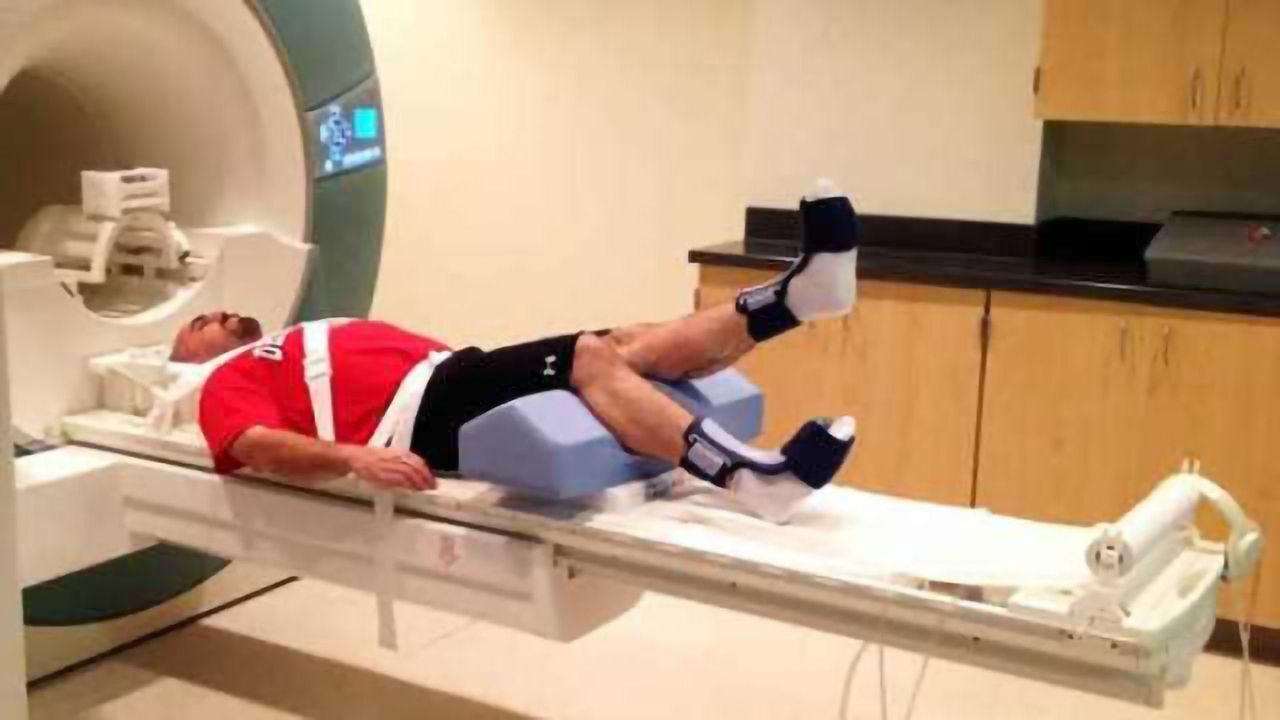 When you injure your knee, it changes your brain