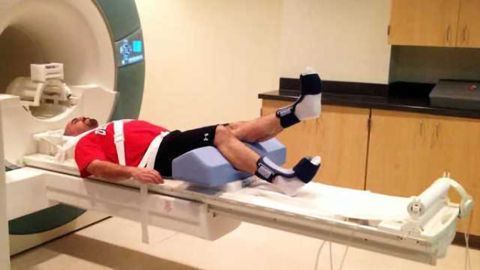 When you injure your knee, it changes your brain